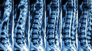 MRI scan image showing sections of the human spine