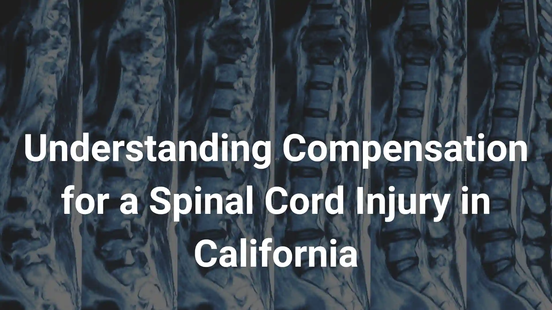 Understanding Compensation for a Spinal Cord Injury in California image